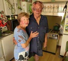 Die beeld van plaasaanvalle